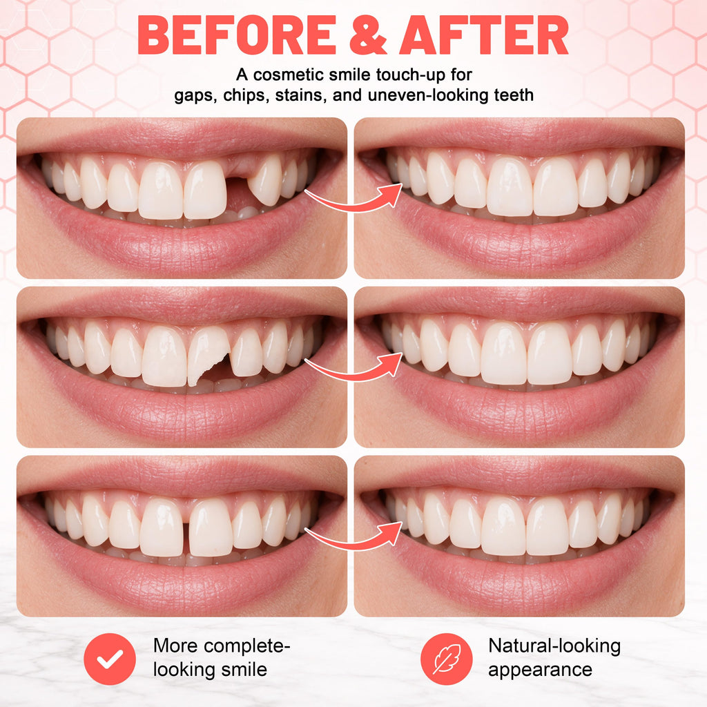 Custom Upper & Lower Dentures L4443